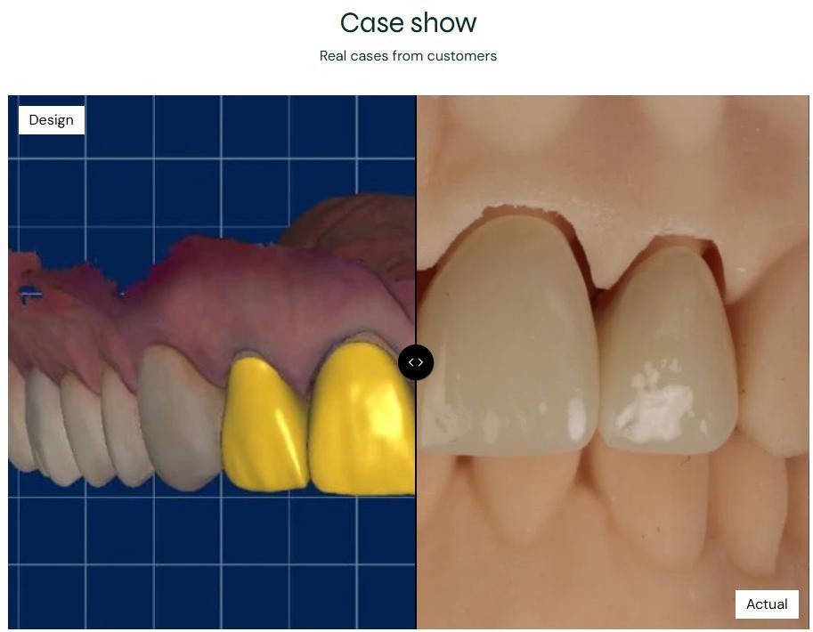 US Dental Lithium Disilicate Glass Ceramic Blocks CEREC Veneer Crown C14 CAD/CAM