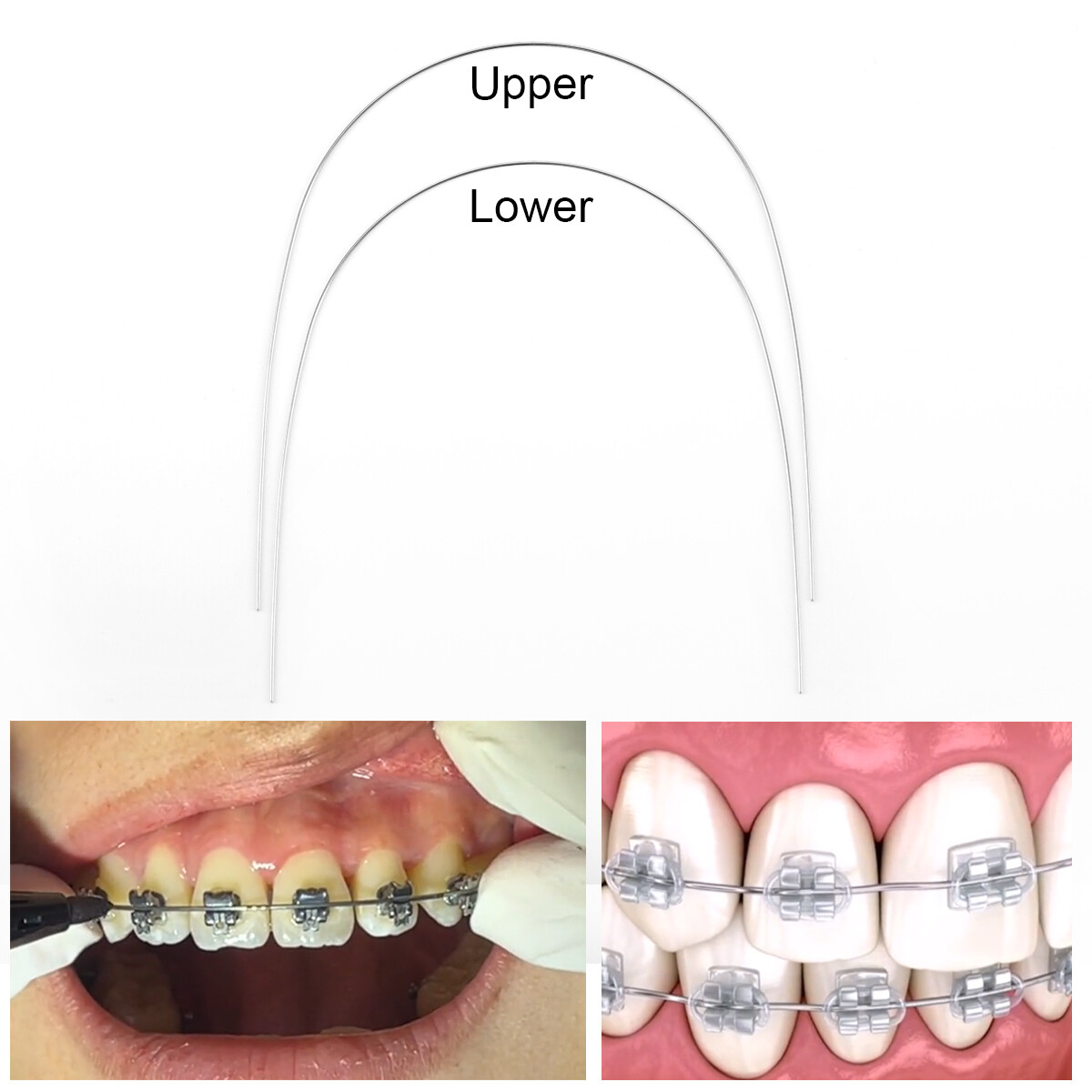 10Pcs/Pack Dental Orthodontic Arch Wire Super Elastic NITI Round Natural Form