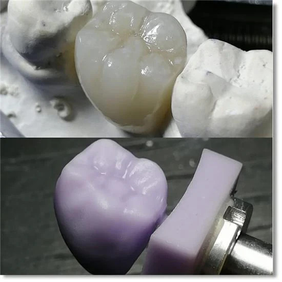 US Dental Lithium Disilicate Glass Ceramic Blocks CEREC Veneer Crown C14 CAD/CAM