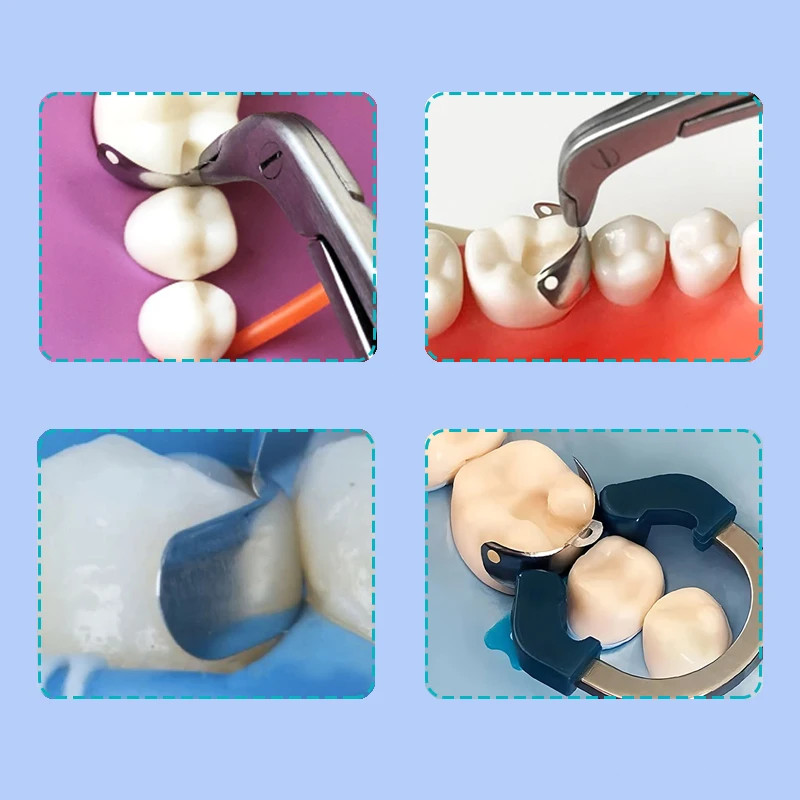 Dental Matrix Bands Ring Sectional Matrix System Tulwar Wedges Fit Palodent V3