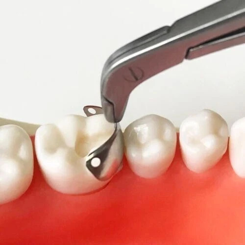 50Pcs Dental Sectional Contoured System Metal Matrices RefillMatrix Bands M4