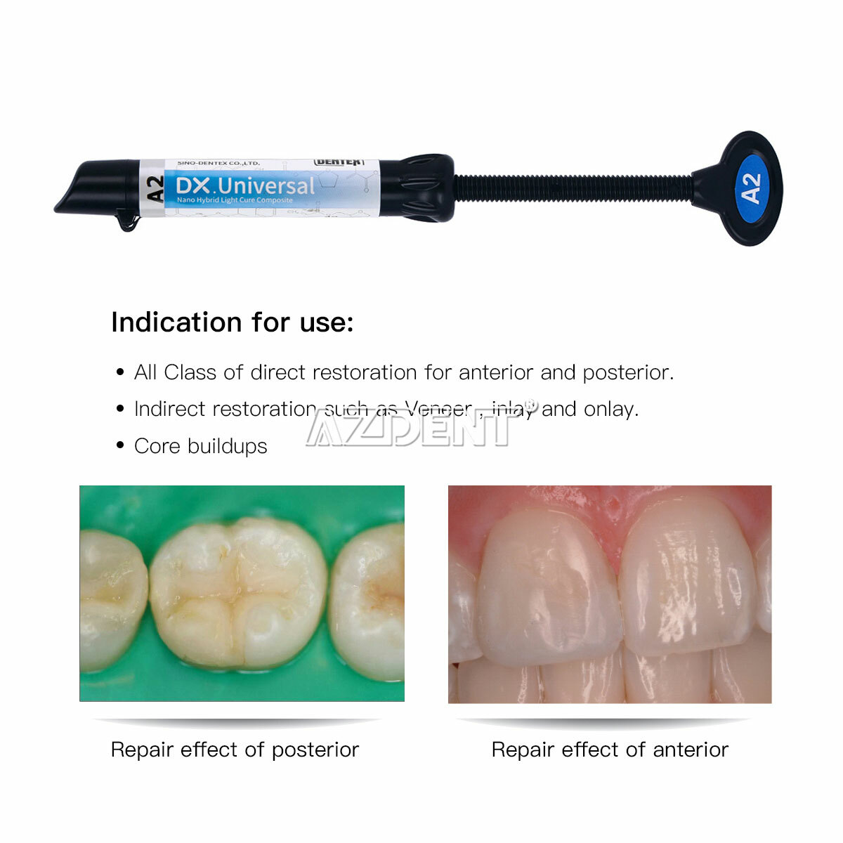 Dental Light Cure Composite Resin / Etching Ge /Orthodontic Brackets Adhesive A2