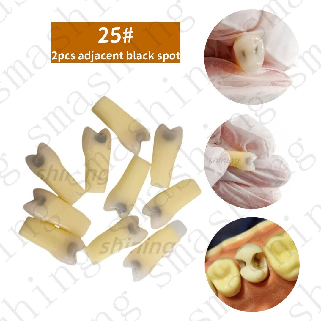 New Dental Cavity Teeth Model Tooth Teaching Caries 25# Fit Frasaco AG-3