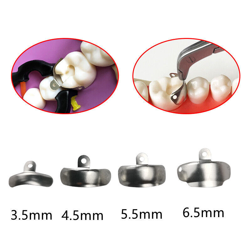 Dental Sectional Matrix Refills Holder Clamp Matrices Bands Titanium Ring Clip